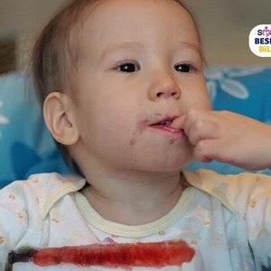 Bebeklerde Alerji Belirtileri